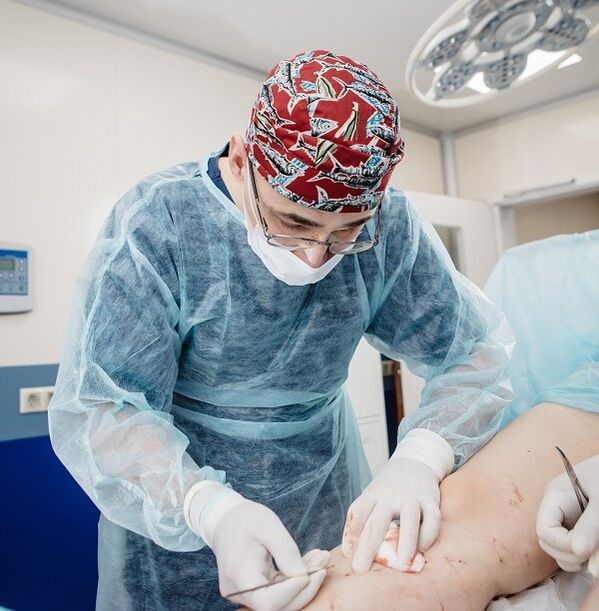 chirurgische behandeling van spataderen