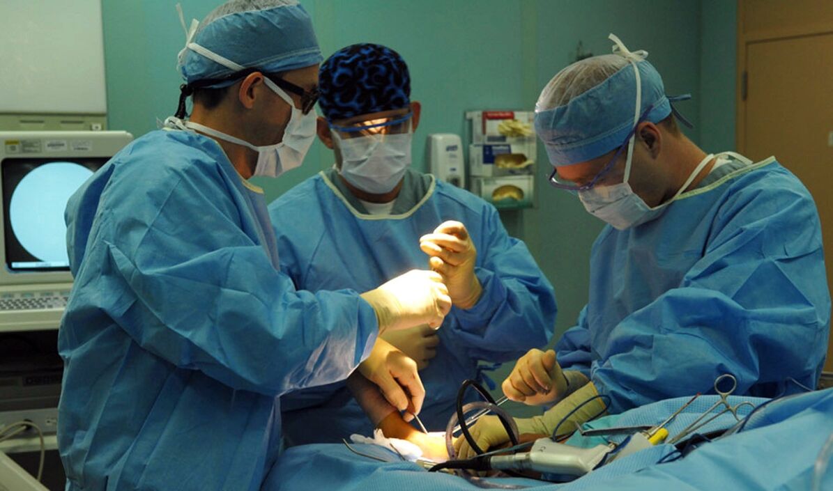 chirurgische behandeling van spataderen