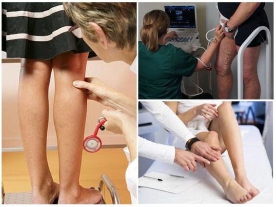 Diagnose van spataderen